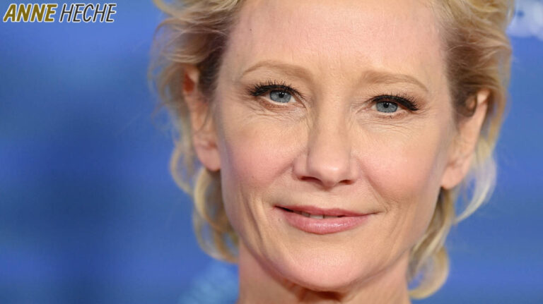 Read more about the article Anne Heche Dead Or Alive